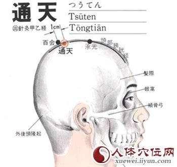 通天穴|通天穴的准确位置图和作用